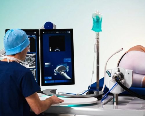 Transrectal Ultrasound